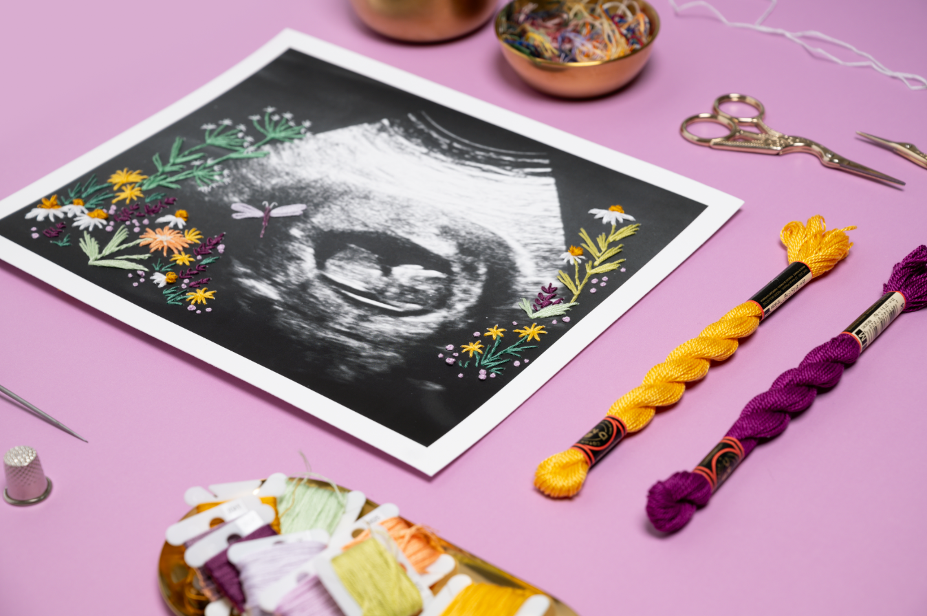 Ultrasound Garden of Life 8x10