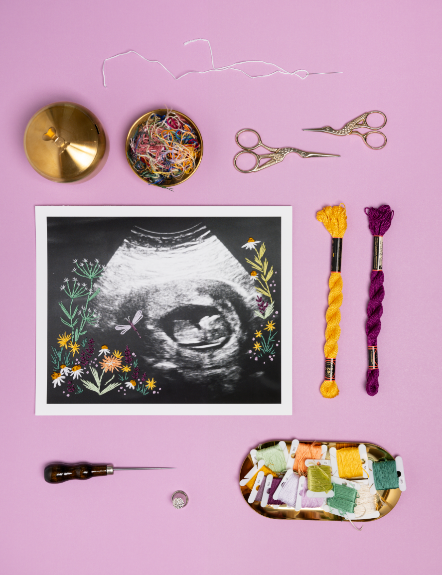 Ultrasound Garden of Life 8x10